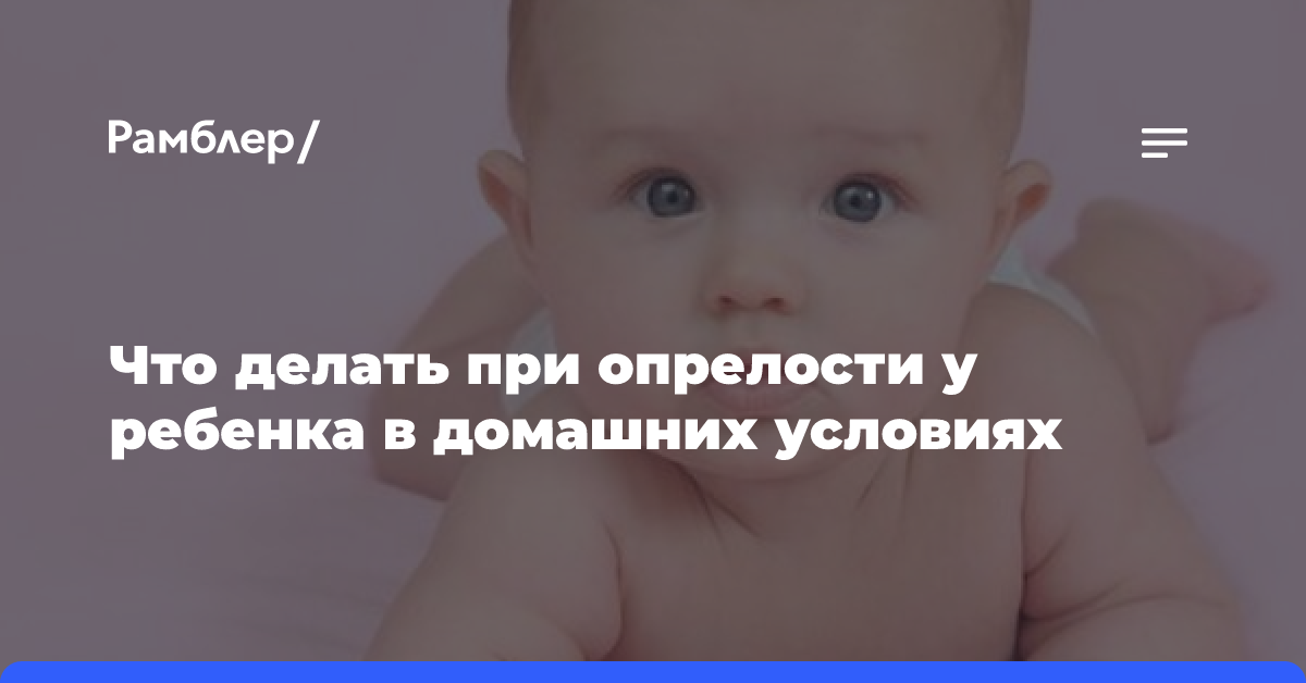 Опять опрелости? 7 советов от специалиста, как избежать этой проблемы