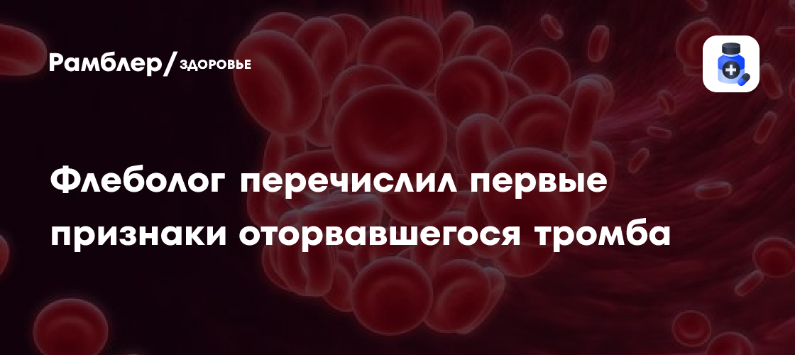 Врач Смирнова перечислила первые признаки оторвавшегося тромба ...