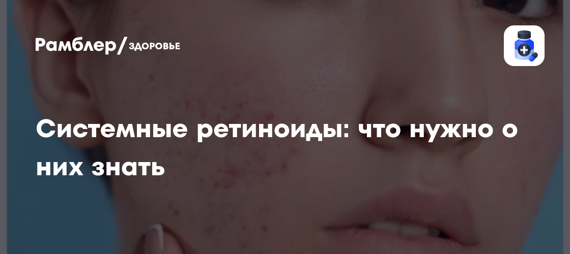 Системные ретиноиды: что нужно о них знать - Рамблер/здоровье