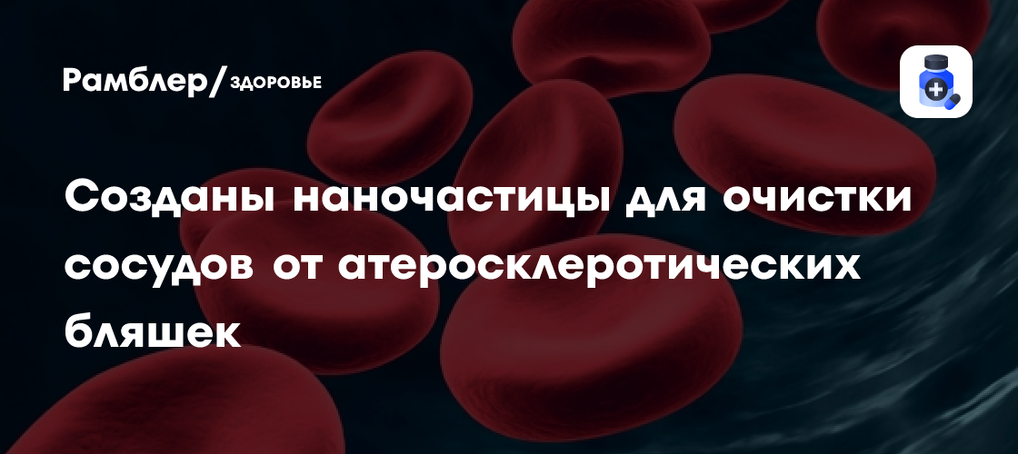 Созданы наночастицы для очистки сосудов от атеросклеротических бляшек ...