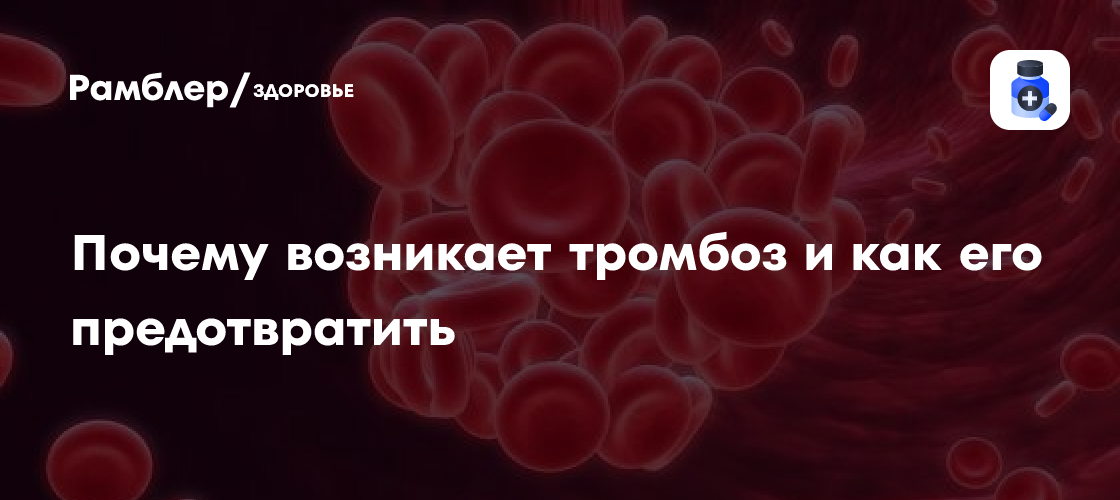 Хирург Григорьян рассказал, почему возникает тромбоз и как его предотвратить