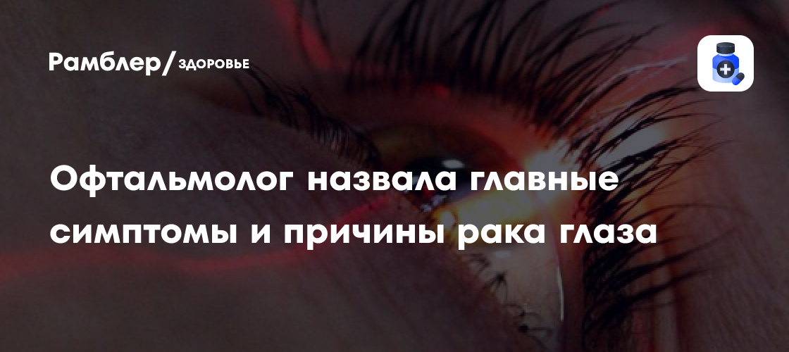 Рак глаза: основные симптомы и причины, о которых рассказала офтальмолог