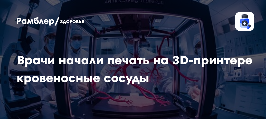 Врачи начали печать на 3D-принтере кровеносные сосуды