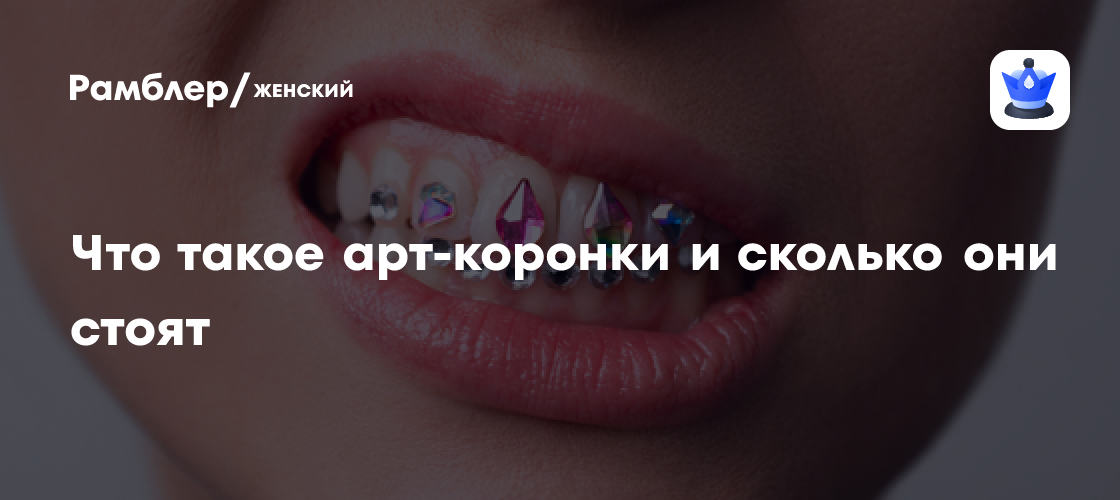Арт-коронки: Новый Тренд в Стоматологии - Стоимость и Особенности