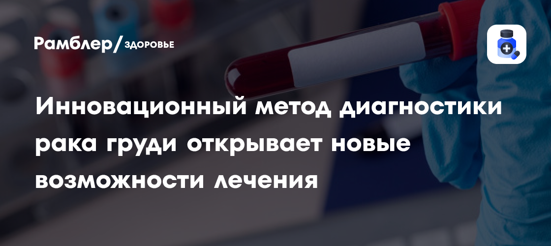 Революция в диагностике рака груди: новый метод открывает новые перспективы лечения