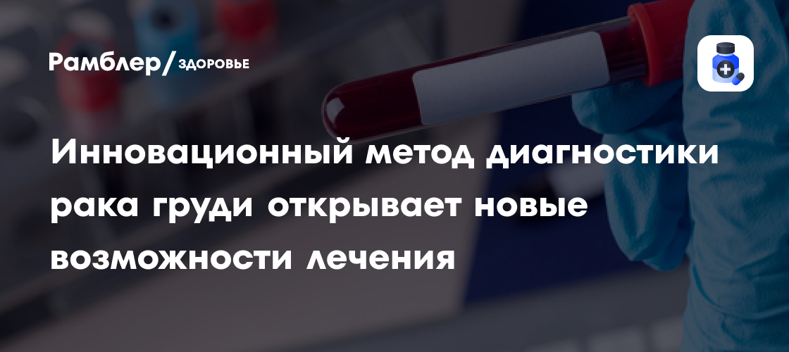 Инновационный метод диагностики рака груди открывает новые возможности лечения