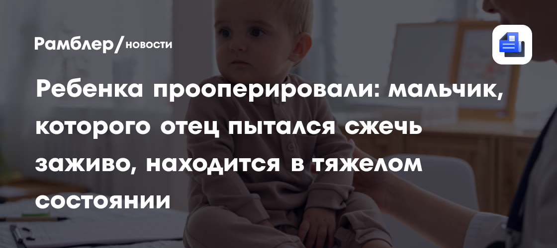 Ребенка прооперировали: мальчик, которого отец пытался сжечь заживо, находится в тяжелом состоянии