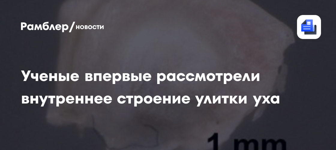 Ученые впервые рассмотрели внутреннее строение улитки уха