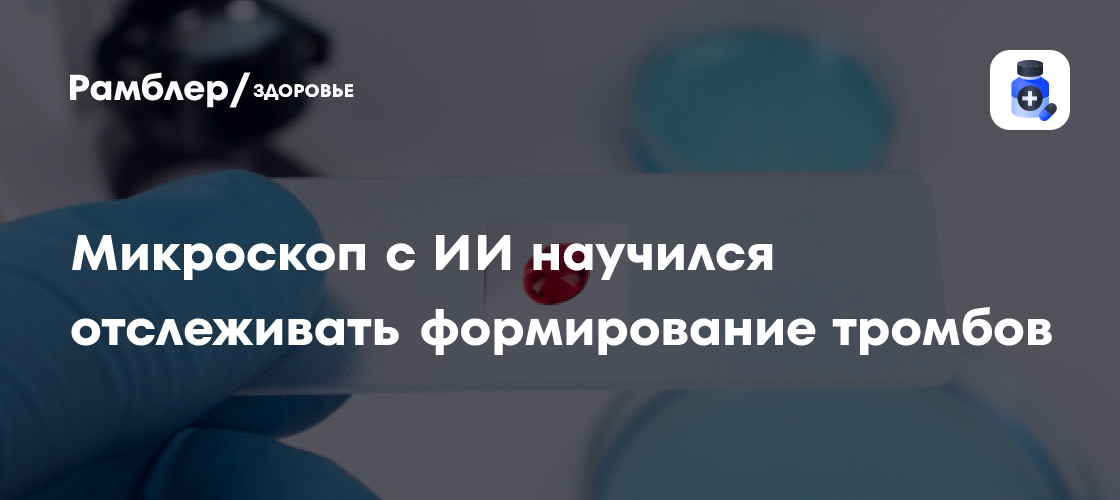 Революция в диагностике: ИИ-микроскоп научился предсказывать образование тромбов