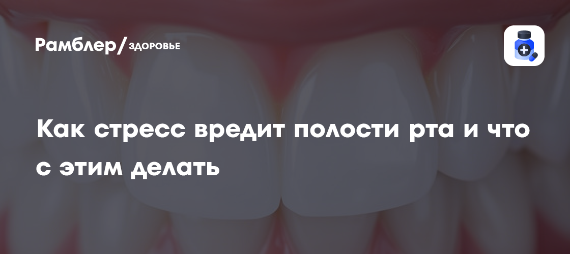 Скрипят зубы от стресса? Как сохранить здоровье зубов под давлением и что делать