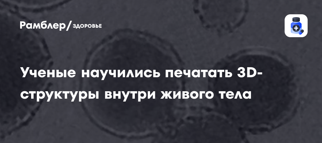 Революция в медицине: 3D-печать внутри тела – новая технология, меняющая будущее лечения