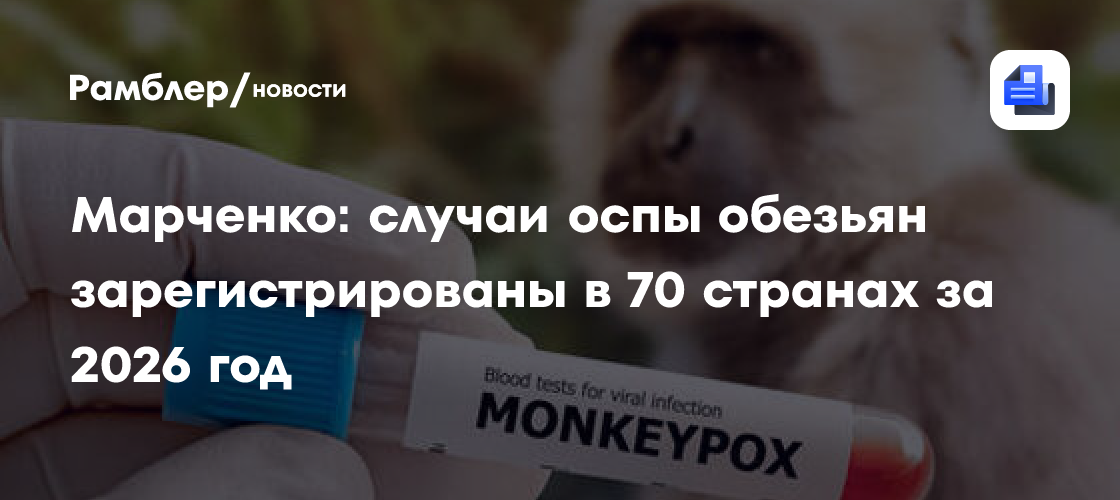 Марченко: случаи оспы обезьян зарегистрированы в 70 странах за 2026 год
