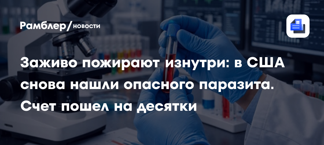 Заживо пожирают изнутри: в США снова нашли опасного паразита. Счет пошел на десятки