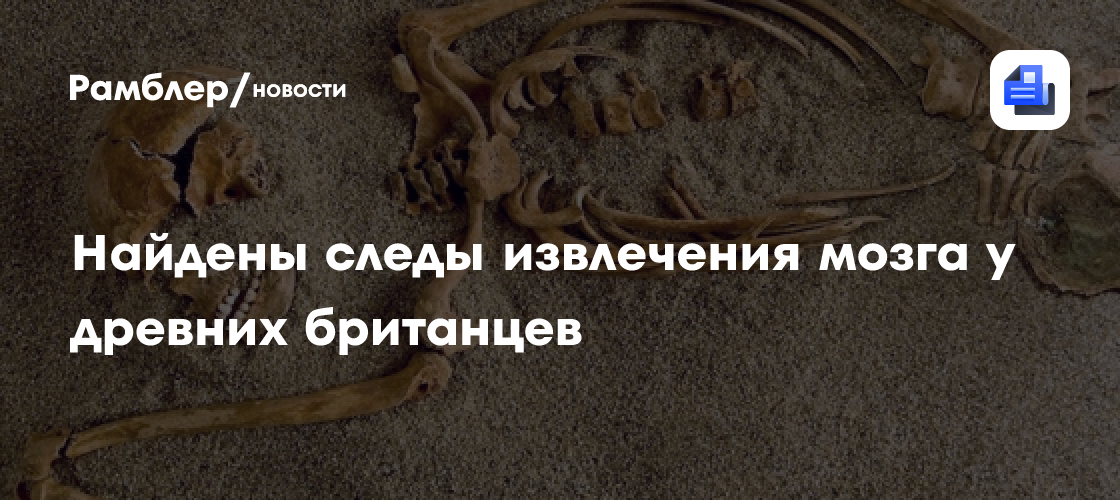 Ученые нашли следы извлечения мозга у древних британцев