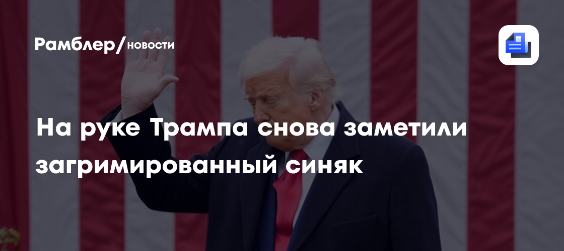 На руке Трампа снова заметили загримированный синяк